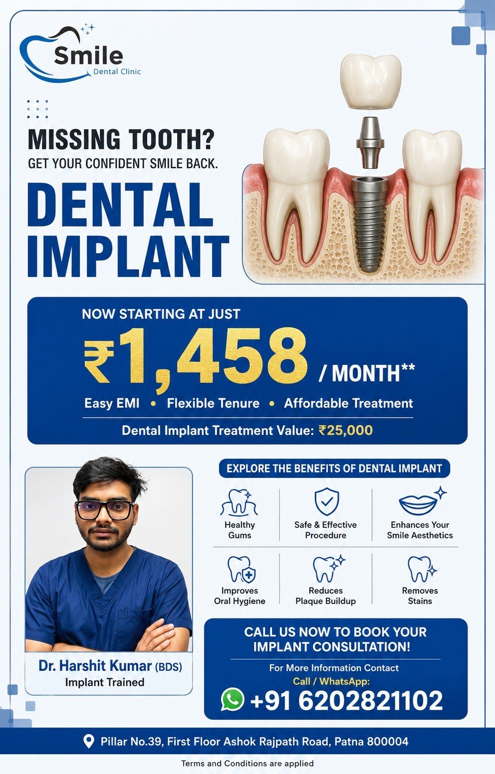 Dental implant treatment limited time offer | osstem implant 50%off